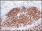 S100 Calcium Binding Protein A4 antibody, 51-091, ProSci, Immunohistochemistry frozen image 