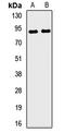 Signaling Lymphocytic Activation Molecule Family Member 1 antibody, LS-C668236, Lifespan Biosciences, Western Blot image 