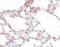 MRE11 Homolog, Double Strand Break Repair Nuclease antibody, PA5-20870, Invitrogen Antibodies, Immunohistochemistry paraffin image 