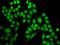 Ran GTPase Activating Protein 1 antibody, GTX65813, GeneTex, Immunofluorescence image 