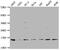 Fatty Acid Binding Protein 4 antibody, CSB-PA007945LA01HU, Cusabio, Western Blot image 