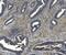 Integrin Subunit Beta 5 antibody, M04201, Boster Biological Technology, Immunohistochemistry paraffin image 