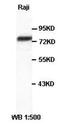 Hematopoietic Cell-Specific Lyn Substrate 1 antibody, orb77142, Biorbyt, Western Blot image 