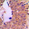 Nuclear Factor Kappa B Subunit 2 antibody, LS-C352571, Lifespan Biosciences, Immunohistochemistry frozen image 