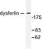 Dysferlin antibody, LS-C175994, Lifespan Biosciences, Western Blot image 