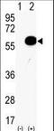 AKT Serine/Threonine Kinase 2 antibody, LS-C98941, Lifespan Biosciences, Western Blot image 