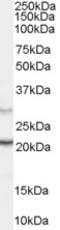 Protein Tyrosine Phosphatase 4A3 antibody, EB05302, Everest Biotech, Western Blot image 