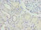 Nucleoporin hCG1 antibody, A63062-100, Epigentek, Immunohistochemistry paraffin image 