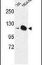 Diaphanous Related Formin 2 antibody, PA5-26414, Invitrogen Antibodies, Western Blot image 