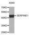 Serpin Family E Member 1 antibody, abx004746, Abbexa, Western Blot image 