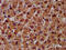 Carbamoyl-Phosphate Synthase 1 antibody, CSB-PA005913LA01HU, Cusabio, Immunohistochemistry frozen image 