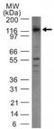 DNA Methyltransferase 3 Alpha antibody, TA336891, Origene, Western Blot image 