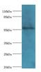 RNA Binding Motif Protein, Y-Linked, Family 1, Member J antibody, LS-C371348, Lifespan Biosciences, Western Blot image 