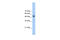 Ferrochelatase, mitochondrial antibody, 29-620, ProSci, Western Blot image 