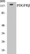 Platelet Derived Growth Factor Receptor Beta antibody, EKC1448, Boster Biological Technology, Western Blot image 