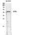 Somatostatin Receptor 2 antibody, STJ97705, St John