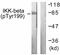 Inhibitor Of Nuclear Factor Kappa B Kinase Subunit Beta antibody, ab59195, Abcam, Western Blot image 