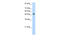 Desmin antibody, 29-586, ProSci, Enzyme Linked Immunosorbent Assay image 