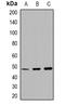 Matrix Metallopeptidase 13 antibody, orb382524, Biorbyt, Western Blot image 