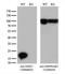 NME/NM23 Nucleoside Diphosphate Kinase 1 antibody, LS-C796839, Lifespan Biosciences, Western Blot image 