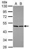 Eukaryotic Translation Initiation Factor 4A2 antibody, PA5-27431, Invitrogen Antibodies, Western Blot image 