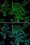 Protein Kinase C Alpha antibody, orb129720, Biorbyt, Immunofluorescence image 