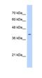 ST6 N-Acetylgalactosaminide Alpha-2,6-Sialyltransferase 6 antibody, orb325303, Biorbyt, Western Blot image 