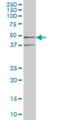 Selenophosphate Synthetase 2 antibody, H00022928-M02, Novus Biologicals, Western Blot image 