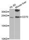 CD70 Molecule antibody, MBS126991, MyBioSource, Western Blot image 