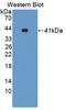 Nuclear Receptor Subfamily 1 Group H Member 3 antibody, LS-C372878, Lifespan Biosciences, Western Blot image 