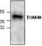 Translocase Of Outer Mitochondrial Membrane 40 antibody, GTX59900, GeneTex, Western Blot image 