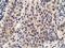 Protein Kinase D2 antibody, LS-C115589, Lifespan Biosciences, Immunohistochemistry paraffin image 