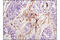 Integrin Subunit Beta 3 antibody, 13166P, Cell Signaling Technology, Immunohistochemistry paraffin image 