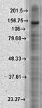 Potassium Sodium-Activated Channel Subfamily T Member 2 antibody, orb67412, Biorbyt, Western Blot image 
