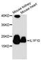 Interleukin 1 Family Member 10 antibody, LS-C748196, Lifespan Biosciences, Western Blot image 