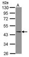 Zinc Finger Protein 302 antibody, NBP2-15169, Novus Biologicals, Western Blot image 