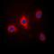 EPH Receptor B3 antibody, orb215466, Biorbyt, Immunofluorescence image 
