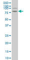 LIM Domain Kinase 1 antibody, LS-B5431, Lifespan Biosciences, Western Blot image 