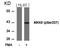 Mitogen-Activated Protein Kinase Kinase 6 antibody, AP02431PU-S, Origene, Western Blot image 