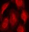 Cyclin Dependent Kinase Inhibitor 1B antibody, orb11204, Biorbyt, Immunofluorescence image 