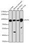 Fucosyltransferase 9 antibody, LS-C763649, Lifespan Biosciences, Western Blot image 