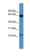 N-acetyllactosaminide beta-1,6-N-acetylglucosaminyl-transferase, isoform C antibody, orb327460, Biorbyt, Western Blot image 