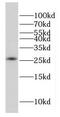Refilin A antibody, FNab02951, FineTest, Western Blot image 