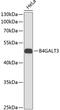 Beta-1,4-Galactosyltransferase 3 antibody, 14-201, ProSci, Western Blot image 