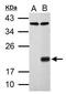 p21 antibody, GTX100444, GeneTex, Western Blot image 