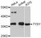 Thymidylate Synthetase antibody, STJ26002, St John