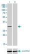 Coenzyme A Synthase antibody, H00080347-M01, Novus Biologicals, Western Blot image 