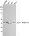 Aldose reductase antibody, M01621-1, Boster Biological Technology, Western Blot image 