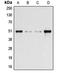 Arrestin Beta 1 antibody, LS-C351848, Lifespan Biosciences, Western Blot image 