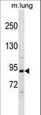 Phosphoinositide-3-Kinase Regulatory Subunit 1 antibody, LS-C157927, Lifespan Biosciences, Western Blot image 